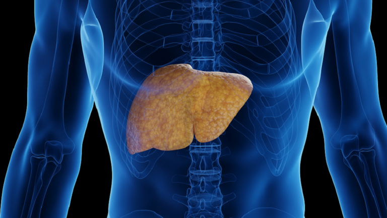 An important warning for liver patients regarding a common food