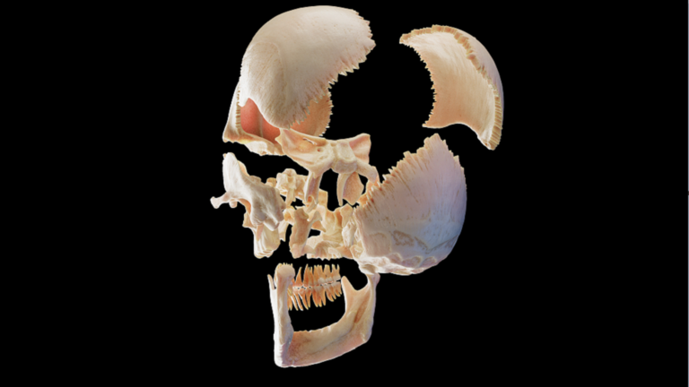 An “distinctive” cranium reveals the traditional Egyptians’ try to deal with most cancers