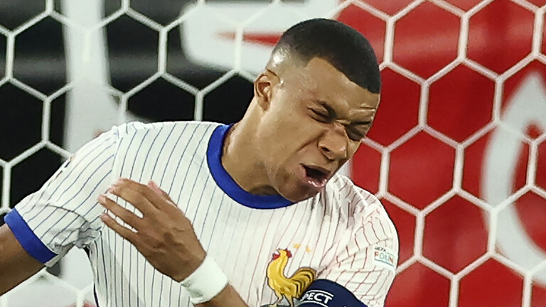 Shock for French followers relating to Mbappe’s damage