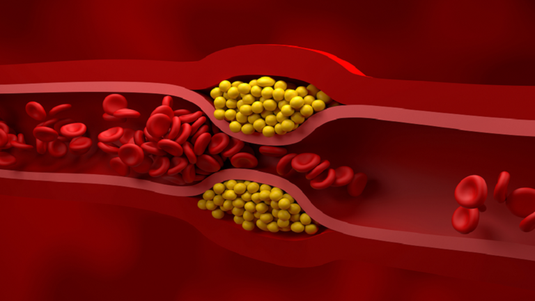 A “secret weapon” to decrease blood ldl cholesterol!