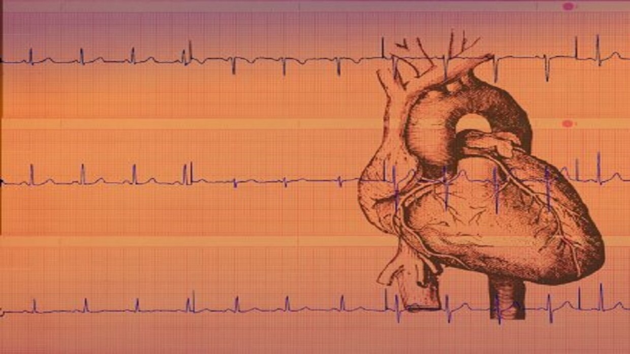 How is the pulse in case of thick blood?