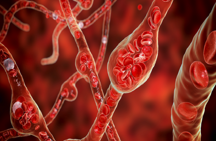 اكتشاف سبب محتمل جديد لارتفاع ضغط الدم وطريقة لعلاجه